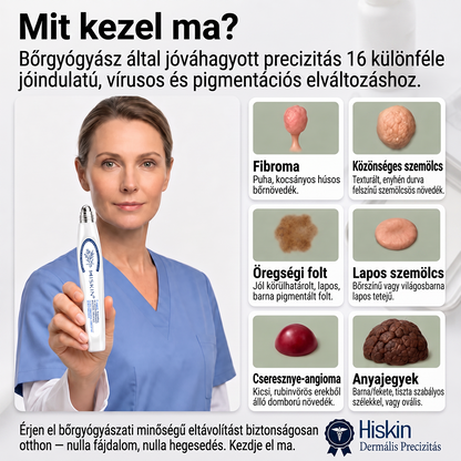 Hivatalos Márkabolt | Hiskin® 7 napos Szemölcseltávolító Roll-on Ápoló Folyadék (Fájdalommentes rollerball technológia, hegek nélkül)