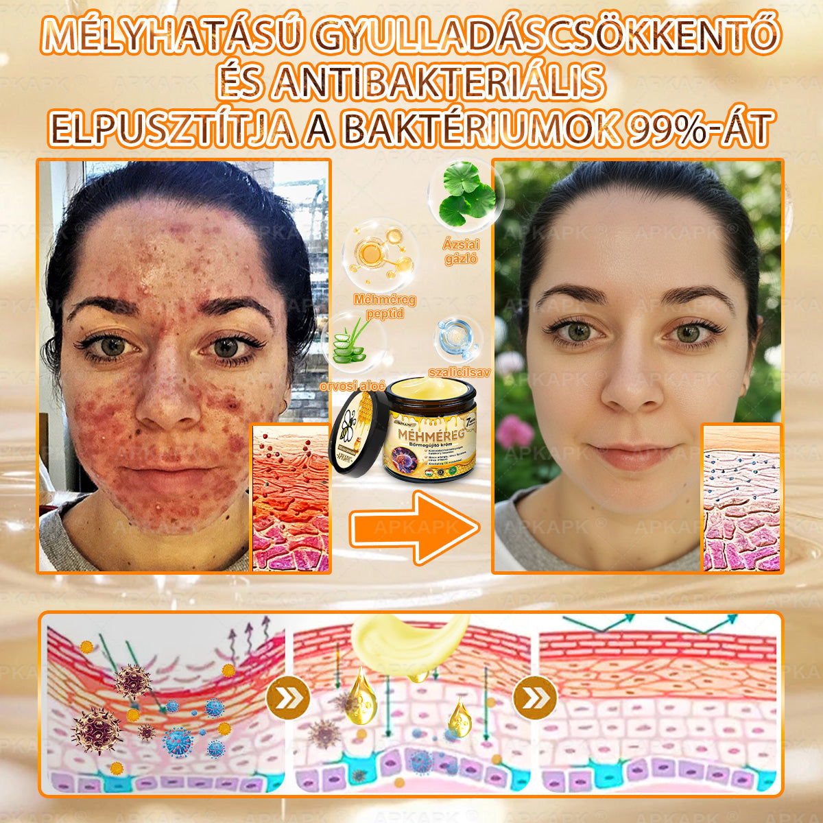 💫APKAPK® 𝐌É𝐇𝐌É𝐑𝐄𝐆 Á𝐓𝐅𝐎𝐆Ó 𝐊𝐑É𝐌𝐀 💛bőrnövedékek 𝐤𝐞𝐳𝐞𝐥é𝐬𝐞 𝐦𝐚𝐠á𝐛𝐚𝐧 𝐟𝐨𝐠𝐥𝐚𝐥𝐣𝐚: é𝐥𝐞𝐭𝐤𝐨𝐫𝐢 𝐟𝐨𝐥𝐭𝐨𝐤, 𝐡𝐞𝐠𝐞𝐤, 𝐬𝐳𝐞𝐦ö𝐥𝐜𝐬ö𝐤, 𝐛ö𝐫𝐧ö𝐯𝐞𝐝é𝐤𝐞𝐤, 𝐭á𝐥𝐲𝐨𝐠𝐨𝐤, 𝐩𝐚𝐭𝐭𝐚𝐧á𝐬𝐨𝐤, 𝐞𝐤𝐜é𝐦𝐚, 𝐩𝐬𝐨𝐫𝐢𝐚𝐬𝐢𝐬, 𝐚𝐜𝐧𝐞 𝐢𝐧𝐯𝐞𝐫𝐬𝐚, 𝐫á𝐧𝐜𝐨𝐤, 𝐛ö𝐫ö𝐫𝐞𝐠𝐞𝐝é𝐬 é𝐬 𝐞𝐠𝐲é𝐛 𝐩𝐫𝐨𝐛𝐥é𝐦á𝐤🔥