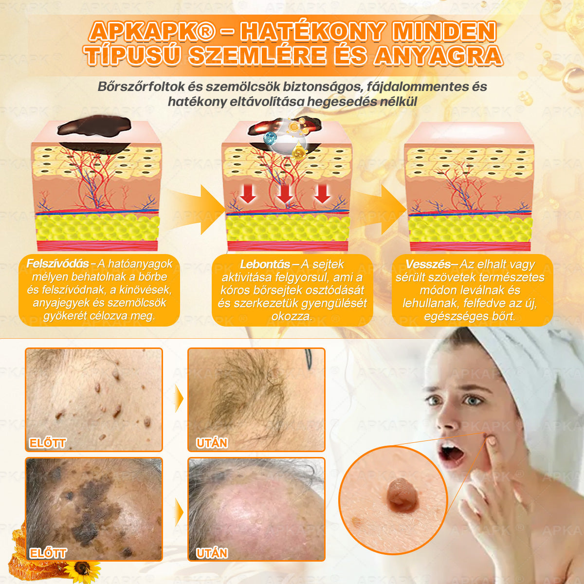 💜APKAPK® 𝐌É𝐇𝐌É𝐑𝐄𝐆 Á𝐓𝐅𝐎𝐆Ó 𝐊𝐑É𝐌𝐀 💛bőrnövedékek 𝐤𝐞𝐳𝐞𝐥é𝐬𝐞 𝐦𝐚𝐠á𝐛𝐚𝐧 𝐟𝐨𝐠𝐥𝐚𝐥𝐣𝐚: é𝐥𝐞𝐭𝐤𝐨𝐫𝐢 𝐟𝐨𝐥𝐭𝐨𝐤, 𝐡𝐞𝐠𝐞𝐤, 𝐬𝐳𝐞𝐦ö𝐥𝐜𝐬ö𝐤, 𝐛ö𝐫𝐧ö𝐯𝐞𝐝é𝐤𝐞𝐤, 𝐭á𝐥𝐲𝐨𝐠𝐨𝐤, 𝐩𝐚𝐭𝐭𝐚𝐧á𝐬𝐨𝐤, 𝐞𝐤𝐜é𝐦𝐚, 𝐩𝐬𝐨𝐫𝐢𝐚𝐬𝐢𝐬, 𝐚𝐜𝐧𝐞 𝐢𝐧𝐯𝐞𝐫𝐬𝐚, 𝐫á𝐧𝐜𝐨𝐤, 𝐛ö𝐫ö𝐫𝐞𝐠𝐞𝐝é𝐬 é𝐬 𝐞𝐠𝐲é𝐛 𝐩𝐫𝐨𝐛𝐥é𝐦á𝐤🔥