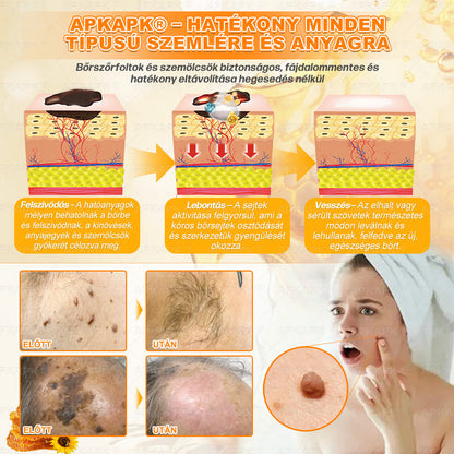 💫APKAPK® 𝐌É𝐇𝐌É𝐑𝐄𝐆 Á𝐓𝐅𝐎𝐆Ó 𝐊𝐑É𝐌𝐀 💛bőrnövedékek 𝐤𝐞𝐳𝐞𝐥é𝐬𝐞 𝐦𝐚𝐠á𝐛𝐚𝐧 𝐟𝐨𝐠𝐥𝐚𝐥𝐣𝐚: é𝐥𝐞𝐭𝐤𝐨𝐫𝐢 𝐟𝐨𝐥𝐭𝐨𝐤, 𝐡𝐞𝐠𝐞𝐤, 𝐬𝐳𝐞𝐦ö𝐥𝐜𝐬ö𝐤, 𝐛ö𝐫𝐧ö𝐯𝐞𝐝é𝐤𝐞𝐤, 𝐭á𝐥𝐲𝐨𝐠𝐨𝐤, 𝐩𝐚𝐭𝐭𝐚𝐧á𝐬𝐨𝐤, 𝐞𝐤𝐜é𝐦𝐚, 𝐩𝐬𝐨𝐫𝐢𝐚𝐬𝐢𝐬, 𝐚𝐜𝐧𝐞 𝐢𝐧𝐯𝐞𝐫𝐬𝐚, 𝐫á𝐧𝐜𝐨𝐤, 𝐛ö𝐫ö𝐫𝐞𝐠𝐞𝐝é𝐬 é𝐬 𝐞𝐠𝐲é𝐛 𝐩𝐫𝐨𝐛𝐥é𝐦á𝐤🔥