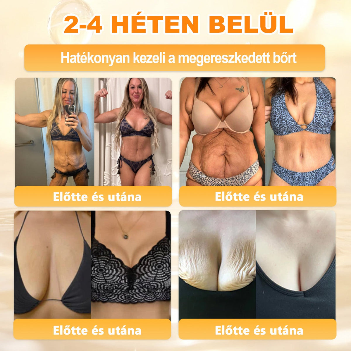 💫APKAPK® 𝐌É𝐇𝐌É𝐑𝐄𝐆 Á𝐓𝐅𝐎𝐆Ó 𝐊𝐑É𝐌𝐀 💛bőrnövedékek 𝐤𝐞𝐳𝐞𝐥é𝐬𝐞 𝐦𝐚𝐠á𝐛𝐚𝐧 𝐟𝐨𝐠𝐥𝐚𝐥𝐣𝐚: é𝐥𝐞𝐭𝐤𝐨𝐫𝐢 𝐟𝐨𝐥𝐭𝐨𝐤, 𝐡𝐞𝐠𝐞𝐤, 𝐬𝐳𝐞𝐦ö𝐥𝐜𝐬ö𝐤, 𝐛ö𝐫𝐧ö𝐯𝐞𝐝é𝐤𝐞𝐤, 𝐭á𝐥𝐲𝐨𝐠𝐨𝐤, 𝐩𝐚𝐭𝐭𝐚𝐧á𝐬𝐨𝐤, 𝐞𝐤𝐜é𝐦𝐚, 𝐩𝐬𝐨𝐫𝐢𝐚𝐬𝐢𝐬, 𝐚𝐜𝐧𝐞 𝐢𝐧𝐯𝐞𝐫𝐬𝐚, 𝐫á𝐧𝐜𝐨𝐤, 𝐛ö𝐫ö𝐫𝐞𝐠𝐞𝐝é𝐬 é𝐬 𝐞𝐠𝐲é𝐛 𝐩𝐫𝐨𝐛𝐥é𝐦á𝐤🔥