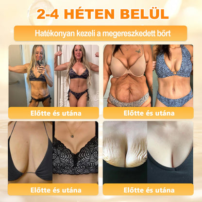 💫APKAPK® 𝐌É𝐇𝐌É𝐑𝐄𝐆 Á𝐓𝐅𝐎𝐆Ó 𝐊𝐑É𝐌𝐀 💛bőrnövedékek 𝐤𝐞𝐳𝐞𝐥é𝐬𝐞 𝐦𝐚𝐠á𝐛𝐚𝐧 𝐟𝐨𝐠𝐥𝐚𝐥𝐣𝐚: é𝐥𝐞𝐭𝐤𝐨𝐫𝐢 𝐟𝐨𝐥𝐭𝐨𝐤, 𝐡𝐞𝐠𝐞𝐤, 𝐬𝐳𝐞𝐦ö𝐥𝐜𝐬ö𝐤, 𝐛ö𝐫𝐧ö𝐯𝐞𝐝é𝐤𝐞𝐤, 𝐭á𝐥𝐲𝐨𝐠𝐨𝐤, 𝐩𝐚𝐭𝐭𝐚𝐧á𝐬𝐨𝐤, 𝐞𝐤𝐜é𝐦𝐚, 𝐩𝐬𝐨𝐫𝐢𝐚𝐬𝐢𝐬, 𝐚𝐜𝐧𝐞 𝐢𝐧𝐯𝐞𝐫𝐬𝐚, 𝐫á𝐧𝐜𝐨𝐤, 𝐛ö𝐫ö𝐫𝐞𝐠𝐞𝐝é𝐬 é𝐬 𝐞𝐠𝐲é𝐛 𝐩𝐫𝐨𝐛𝐥é𝐦á𝐤🔥