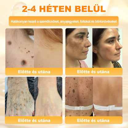 💫APKAPK® 𝐌É𝐇𝐌É𝐑𝐄𝐆 Á𝐓𝐅𝐎𝐆Ó 𝐊𝐑É𝐌𝐀 💛bőrnövedékek 𝐤𝐞𝐳𝐞𝐥é𝐬𝐞 𝐦𝐚𝐠á𝐛𝐚𝐧 𝐟𝐨𝐠𝐥𝐚𝐥𝐣𝐚: é𝐥𝐞𝐭𝐤𝐨𝐫𝐢 𝐟𝐨𝐥𝐭𝐨𝐤, 𝐡𝐞𝐠𝐞𝐤, 𝐬𝐳𝐞𝐦ö𝐥𝐜𝐬ö𝐤, 𝐛ö𝐫𝐧ö𝐯𝐞𝐝é𝐤𝐞𝐤, 𝐭á𝐥𝐲𝐨𝐠𝐨𝐤, 𝐩𝐚𝐭𝐭𝐚𝐧á𝐬𝐨𝐤, 𝐞𝐤𝐜é𝐦𝐚, 𝐩𝐬𝐨𝐫𝐢𝐚𝐬𝐢𝐬, 𝐚𝐜𝐧𝐞 𝐢𝐧𝐯𝐞𝐫𝐬𝐚, 𝐫á𝐧𝐜𝐨𝐤, 𝐛ö𝐫ö𝐫𝐞𝐠𝐞𝐝é𝐬 é𝐬 𝐞𝐠𝐲é𝐛 𝐩𝐫𝐨𝐛𝐥é𝐦á𝐤🔥